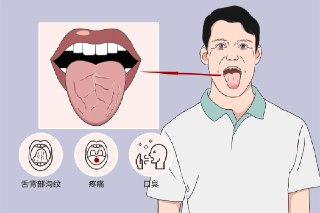 杨春虎舌诊精品面授课(25节视频课程)[免费在线观看][夸克网盘]