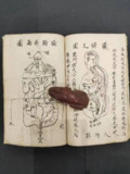 太医院補遺真伝医学正伝