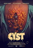 囊肿 CYST (2020) 1080p 原盘Remux 中文字幕 【14.80GB】已刮削