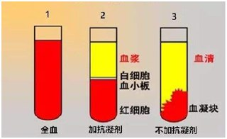 【游戏】《血清》